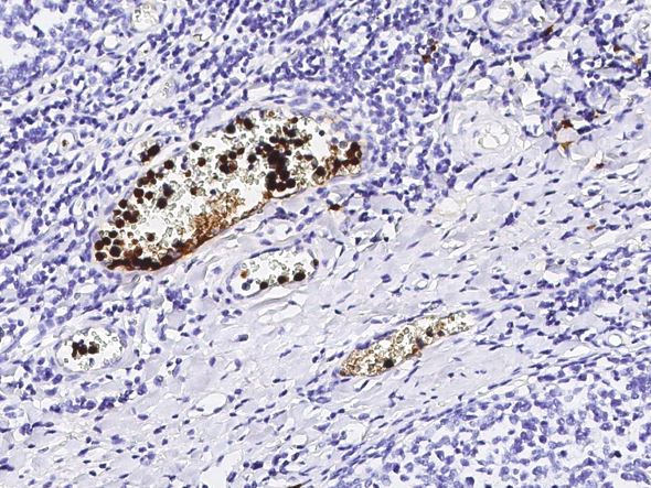 S100A12 antibody [133]