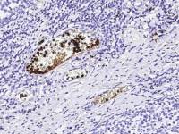 S100A12 antibody [133]