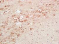 Thyrotropin releasing hormone antibody