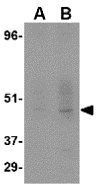 DC-SIGN antibody [5D7]