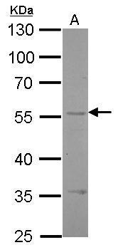 Endothelin B Receptor antibody [C3], C-term