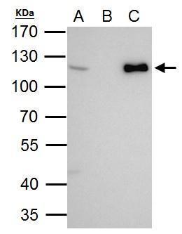CHD1L antibody [N2C1], Internal