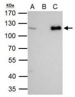 CHD1L antibody [N2C1], Internal