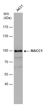 MACC1 antibody