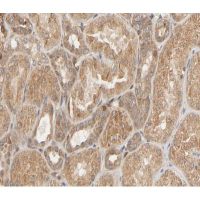 HSP27 (phospho Ser82) antibody