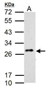 CLEC5A antibody