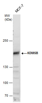 KDM5B antibody