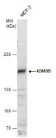 KDM5B antibody