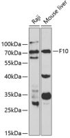 Factor X antibody