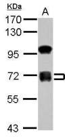 ZNF182 antibody