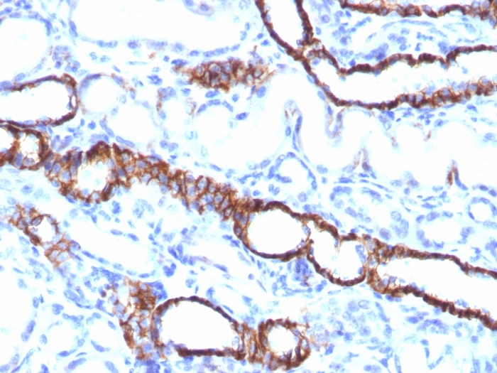 CDH16 antibody [CDH16/1532R]