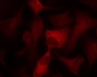 AMPK alpha 1 + AMPK alpha 2 antibody