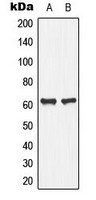 PLA2G4C antibody