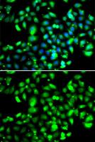 GBP1 antibody