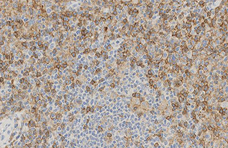 CD4 antibody [4B12]