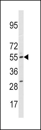 CYP11A1 antibody, N-term
