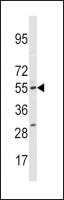 CYP11A1 antibody, N-term