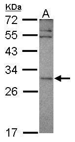 SNF8 antibody