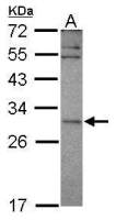 SNF8 antibody