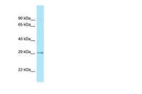 CDX2 antibody, Internal