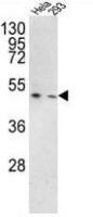 TMPRSS3 antibody, Internal