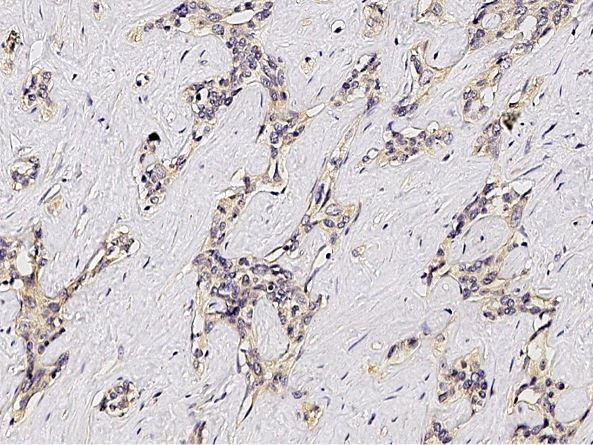 ASGPR1 antibody [011]