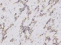 ASGPR1 antibody [011]