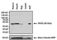 PAX5 antibody