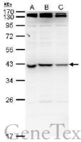 nm23-H7 antibody
