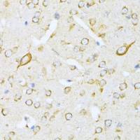 Valyl tRNA synthetase antibody