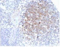 Interferon alpha 1 antibody [IFNA/6689]