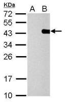 PITX2 antibody