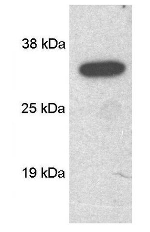 SCAMP 1 antibody