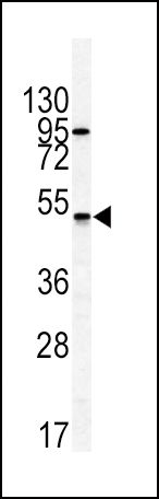 GIPR antibody, N-term