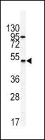 GIPR antibody, N-term