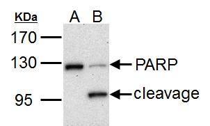 PARP antibody