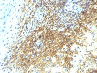 CD44v4 antibody [CD44v4/1219]