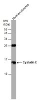 Cystatin C antibody