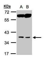ACOT8 antibody [N1C3]