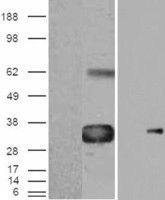 WISP1 antibody, C-term