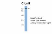 CLCN5 antibody, Internal