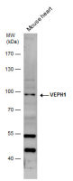 VEPH1 antibody