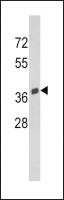 SPARC antibody, C-term