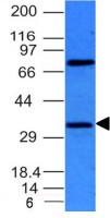 BCL10 antibody [BL10/411]