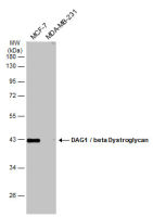 DAG1 / beta Dystroglycan antibody [C2C3-2], C-term