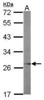 UBC3B antibody