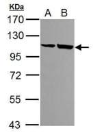 alpha Actinin 4 antibody [N1N2], N-term