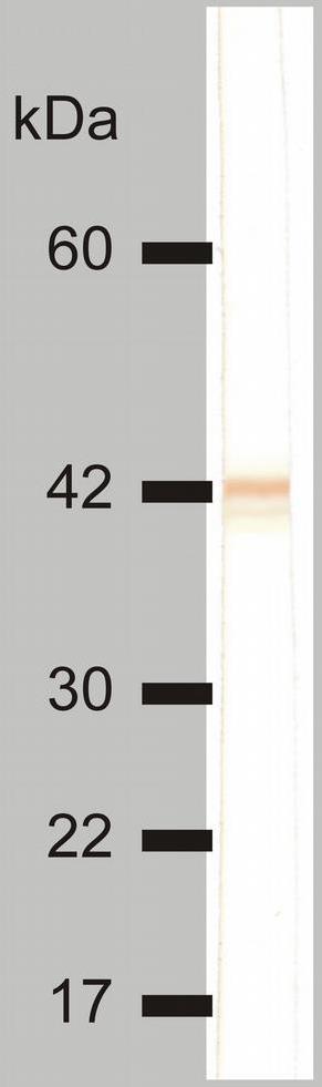 Cytokeratin 18 antibody [DC-10]
