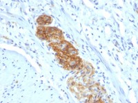 NCAM antibody [NCAM1/784]