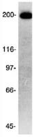 CKAP5 antibody